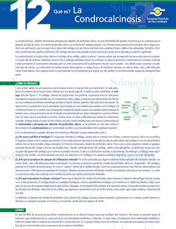 Cache grafica http://www.ser.es/ArchivosDESCARGABLES/Folletos/12.pdf  