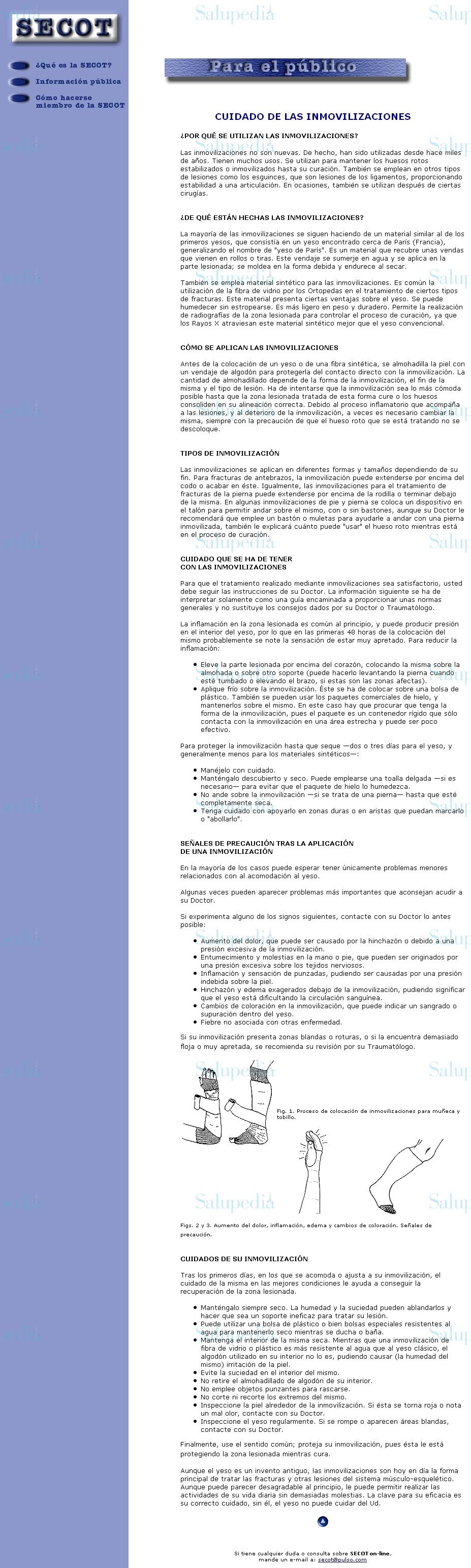 Cache grafica http://www.pulso.com/secot/17.htm  