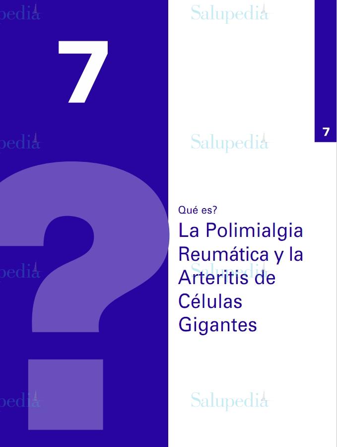 Cache grafica http://www.ser.es/ArchivosDESCARGABLES/Folletos/07.pdf  