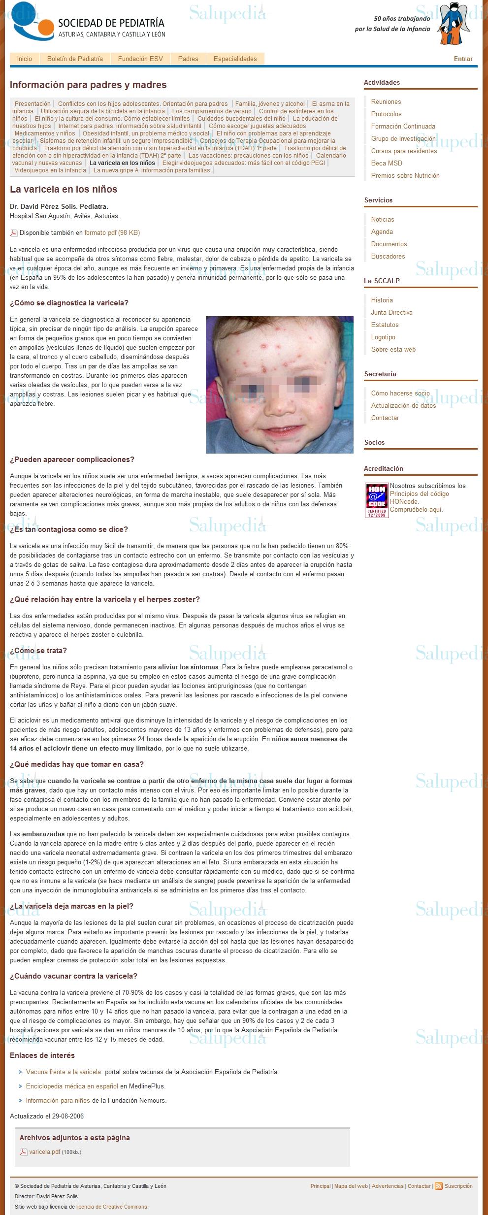 Cache grafica http://www.sccalp.org/pages/101-la-varicela-en-los-ninnos  