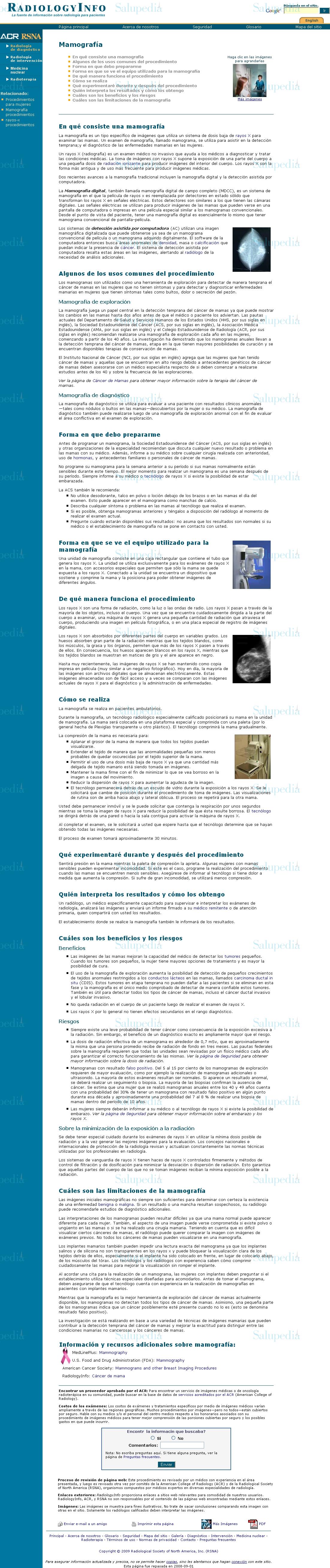 Cache grafica http://www.radiologyinfo.org/sp/info.cfm?pg=mammo  