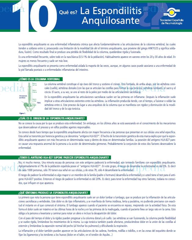 Cache grafica http://www.ser.es/ArchivosDESCARGABLES/Folletos/10.pdf  