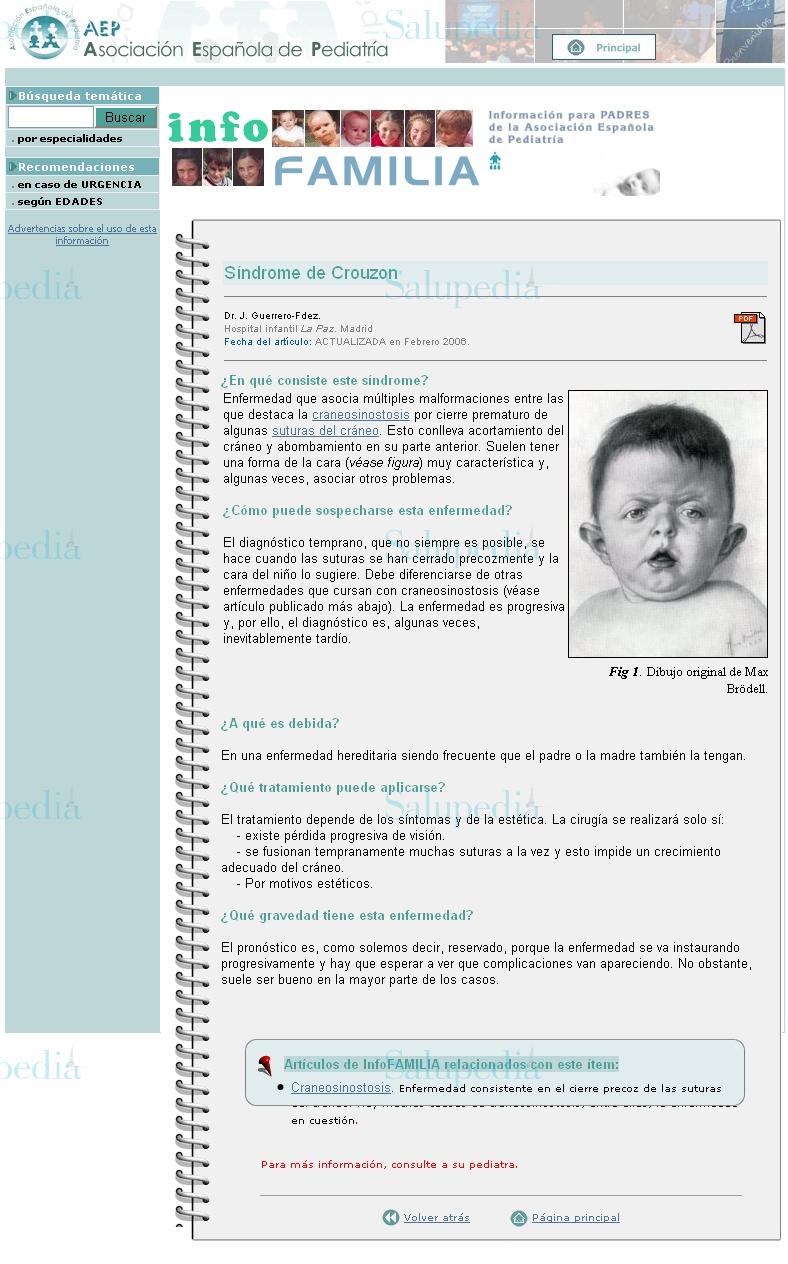 Cache grafica http://www.aeped.es/infofamilia/temas/crouzon.htm  