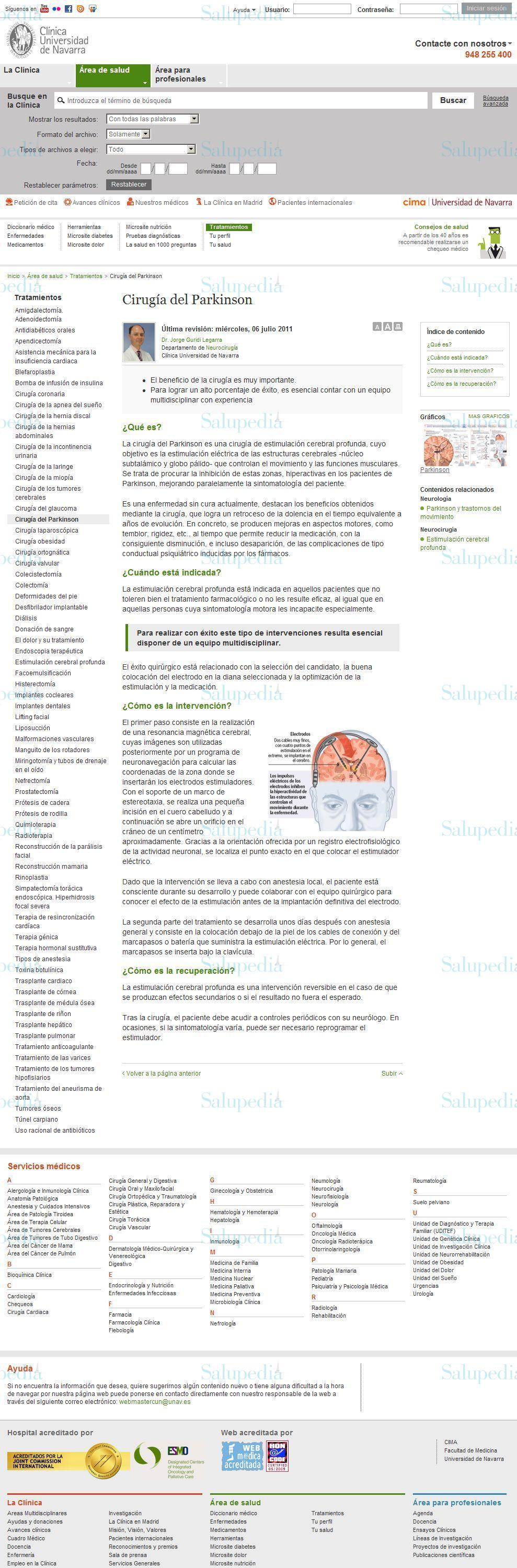 Cache grafica http://www.cun.es/area-salud/Tratamientos/cirugia-parkinson  