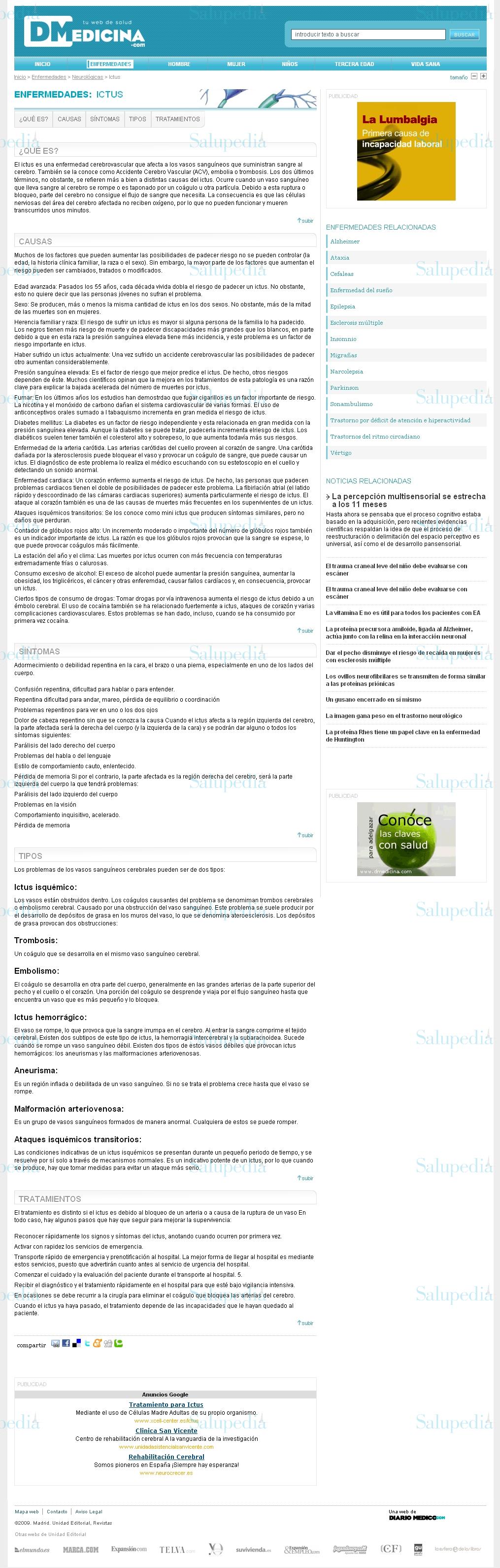 Cache grafica http://www.dmedicina.com/salud/neurologicas/ictus.html  