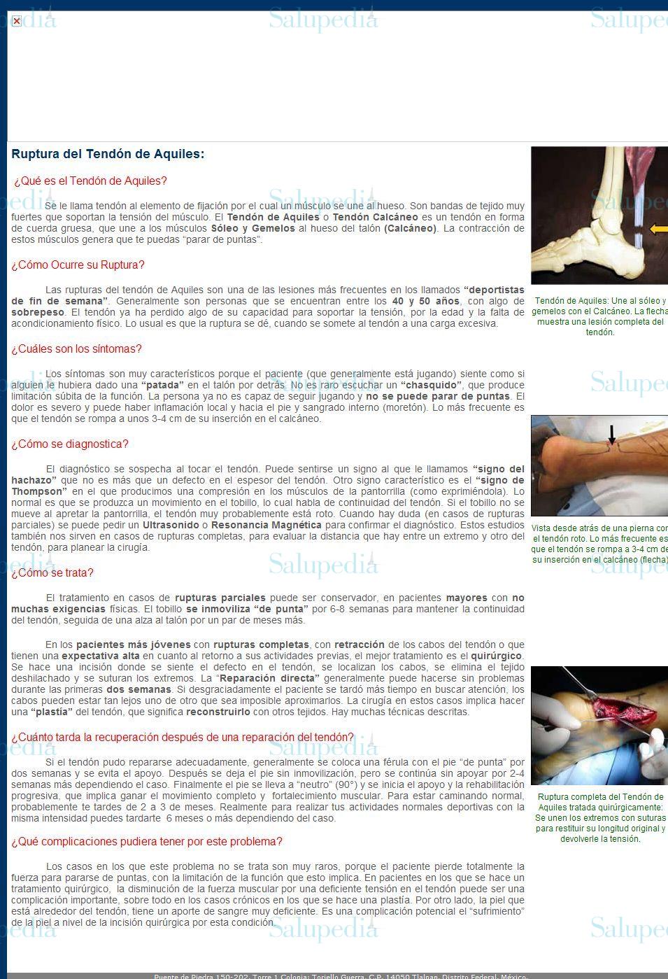 Cache grafica http://ortopediadeportiva.com.mx/t04.html  