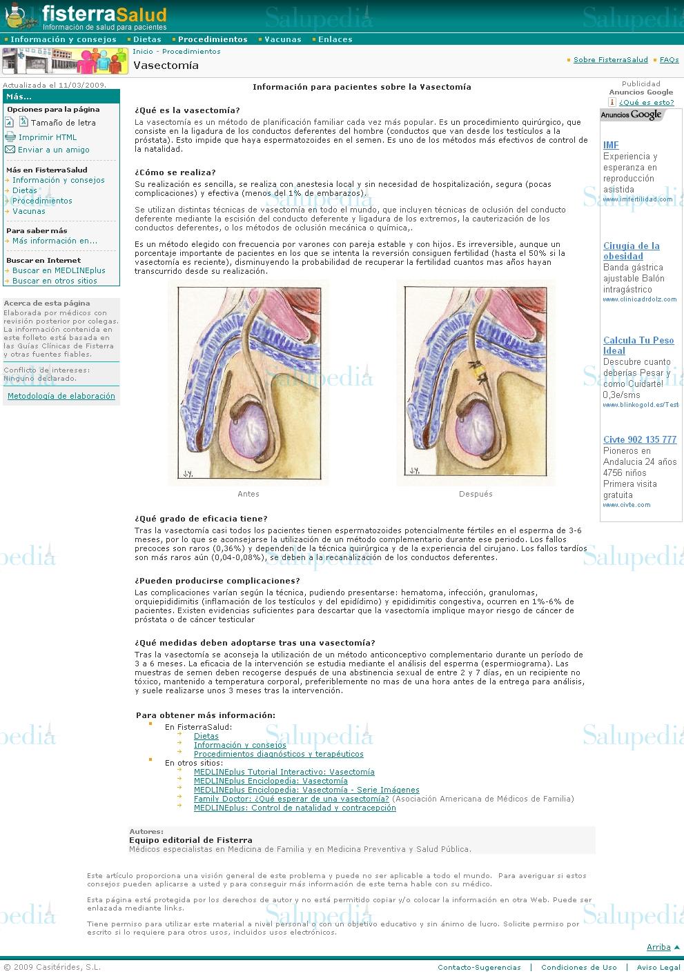 Cache grafica http://www.fisterra.com/Salud/3proceDT/vasectomia.asp  