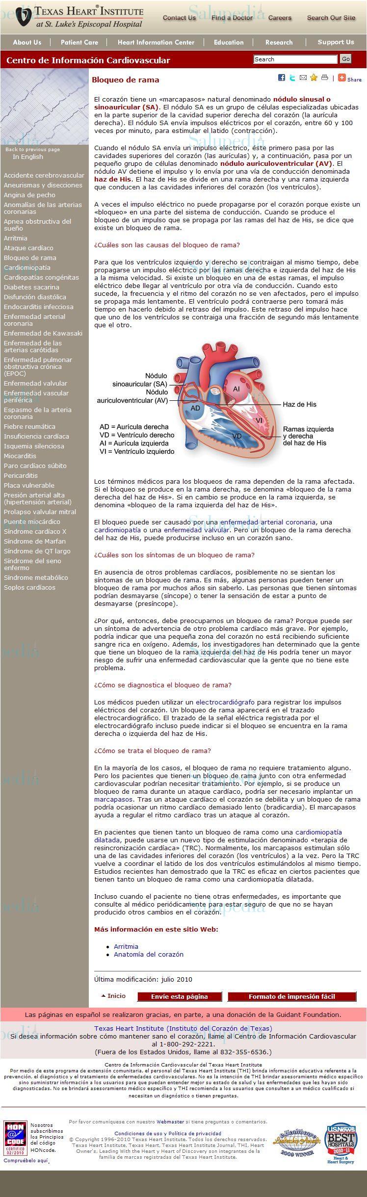 Cache grafica http://www.texasheartinstitute.org/HIC/Topics_Esp/Cond/bbblo_sp.cfm  