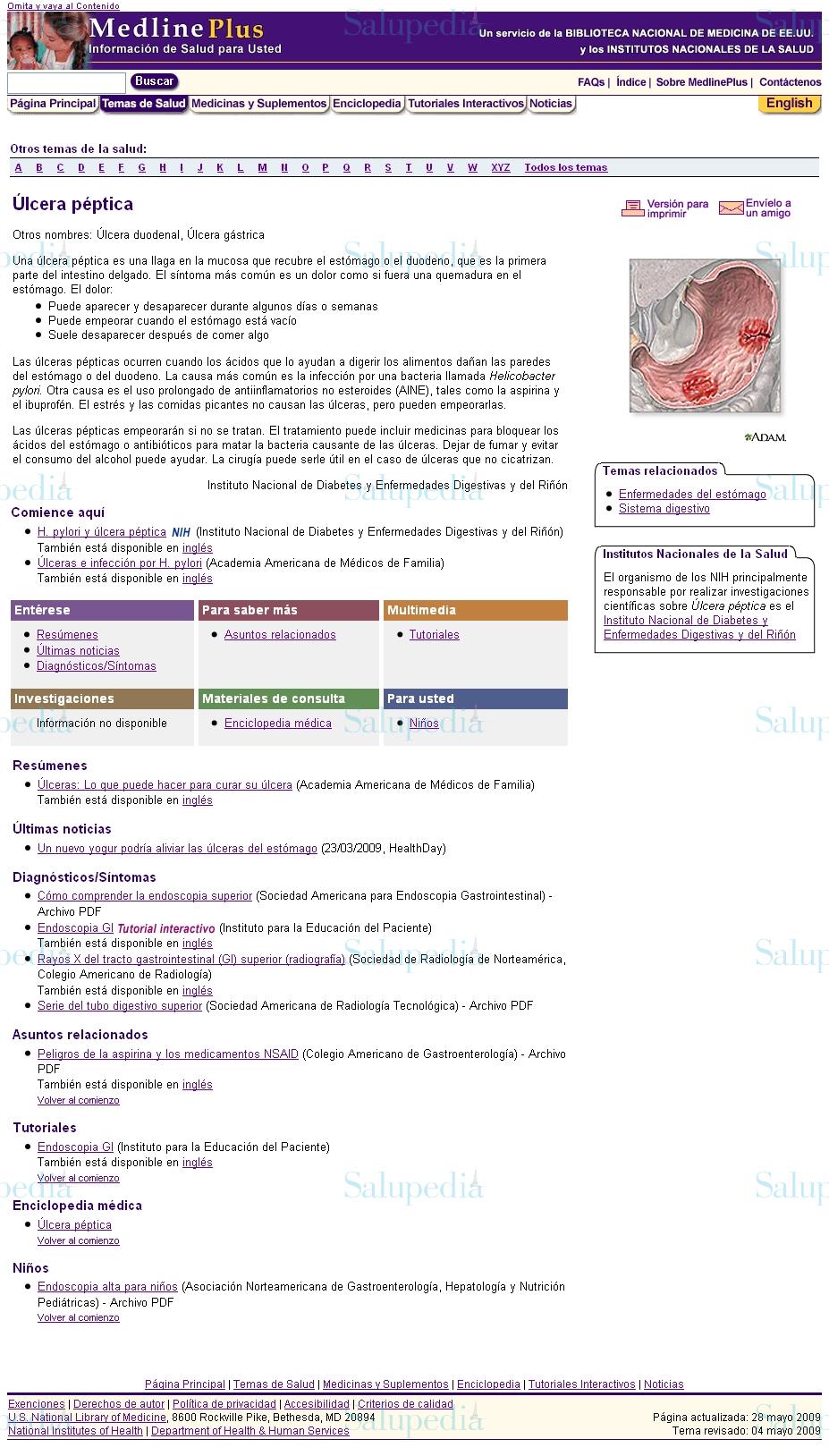 Cache grafica http://www.nlm.nih.gov/medlineplus/spanish/pepticulcer.html  