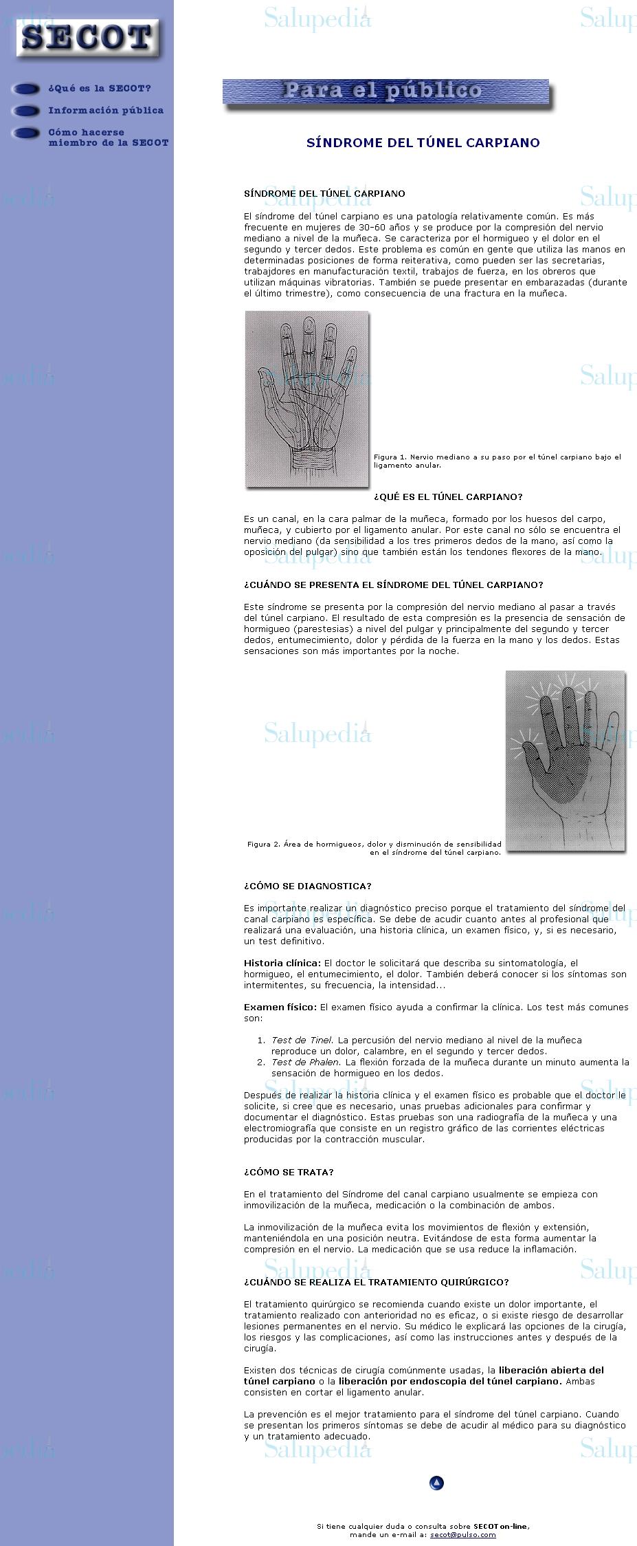 Cache grafica http://www.pulso.com/secot/25.htm  