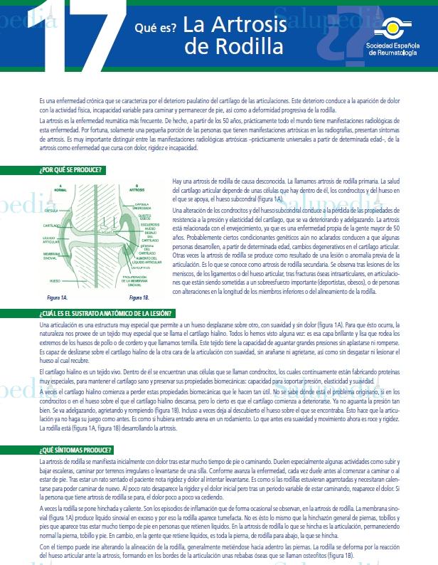 Cache grafica http://www.ser.es/ArchivosDESCARGABLES/Folletos/17.pdf  