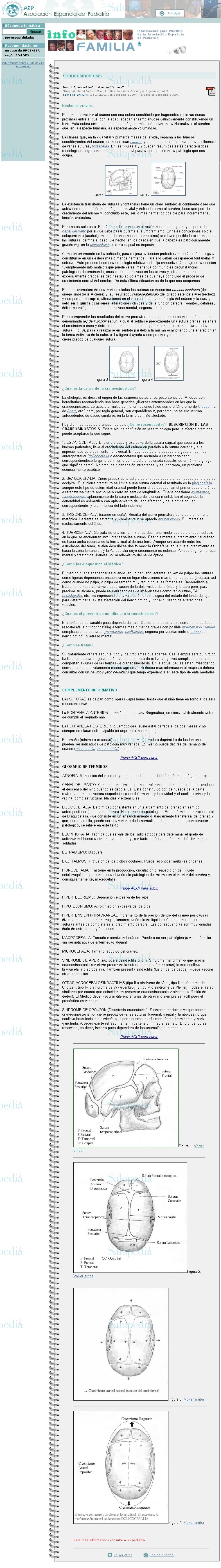 Cache grafica http://www.aeped.es/infofamilia/temas/craneosinostosis.htm#1  