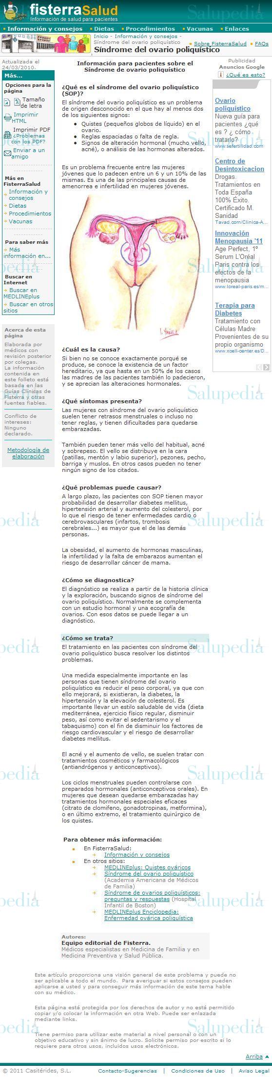 Cache grafica http://www.fisterra.com/Salud/1infoConse/ovarioPoliquistico.asp  