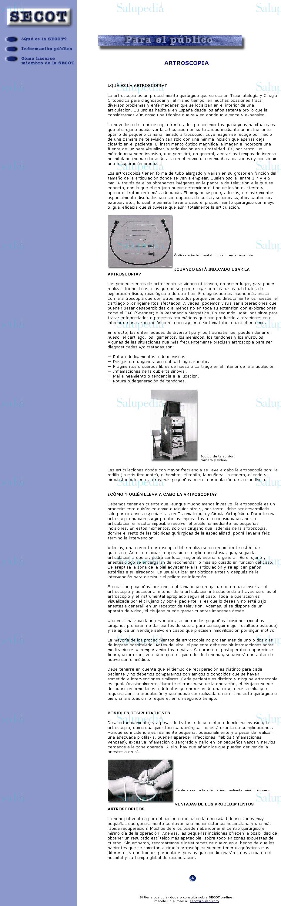 Cache grafica http://www.pulso.com/secot/21.htm  