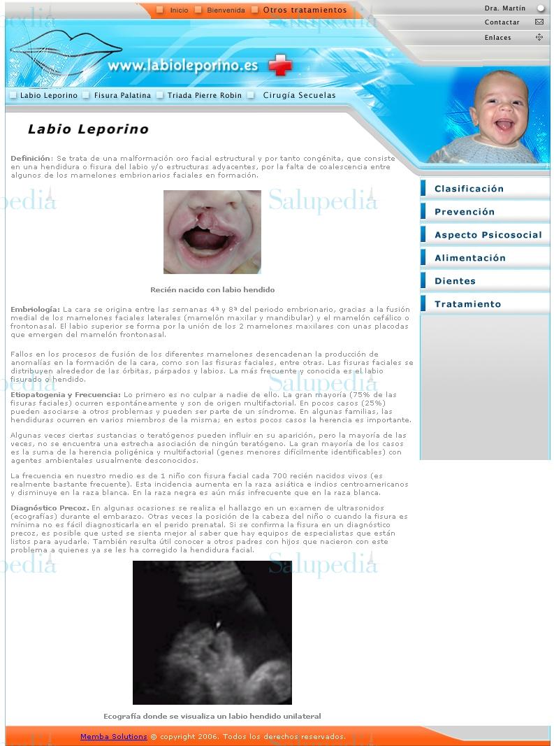Cache grafica http://www.labioleporino.es/labio_leporino.php  