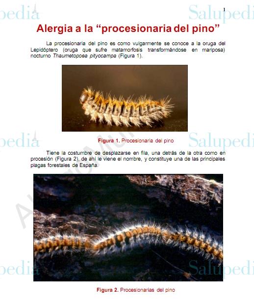 Cache grafica http://alergomurcia.com/pdf/Alergia_a_procesionaria_del_pino.pdf  