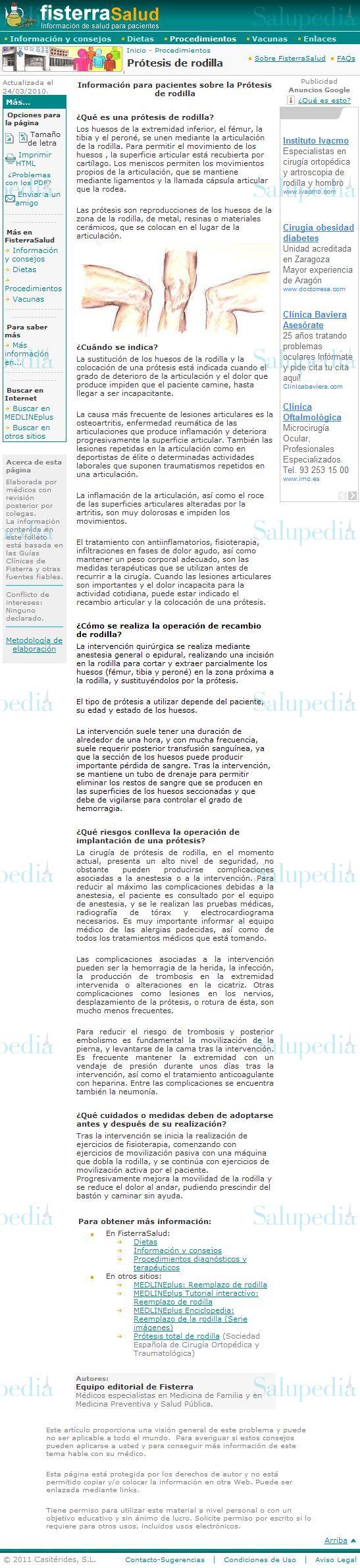 Cache grafica http://www.fisterra.com/Salud/3proceDT/protesisRodilla.asp  