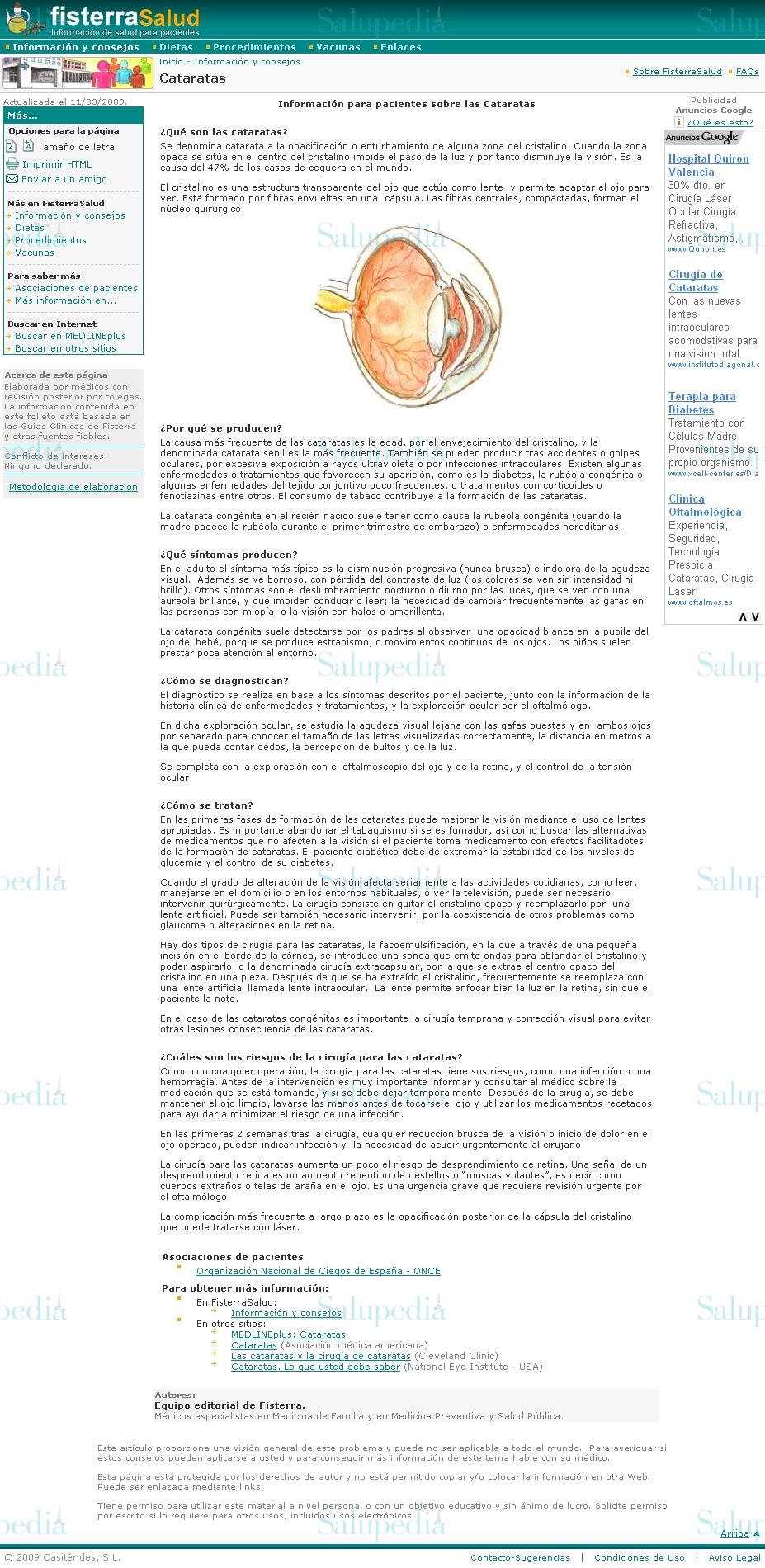 Cache grafica http://www.fisterra.com/Salud/1infoConse/cataratas.asp  