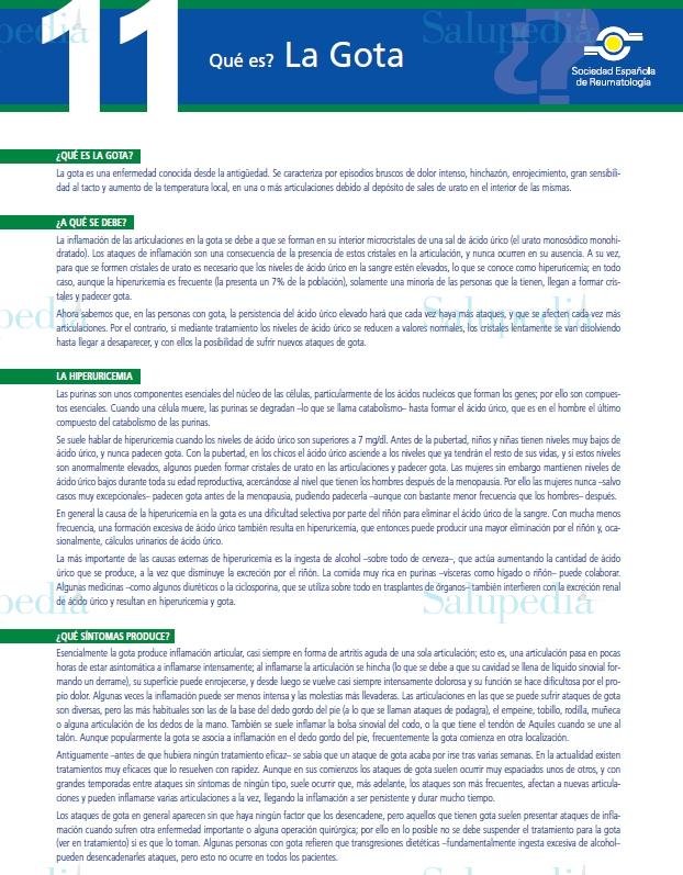 Cache grafica http://www.ser.es/ArchivosDESCARGABLES/Folletos/11.pdf  