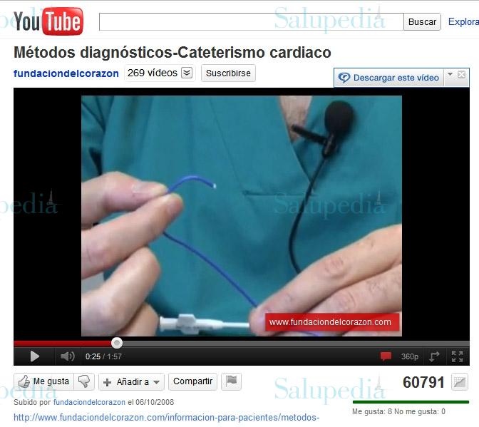 Cache grafica http://www.youtube.com/watch?v=Fbc-oI5-KJI&feature=player_embedded  