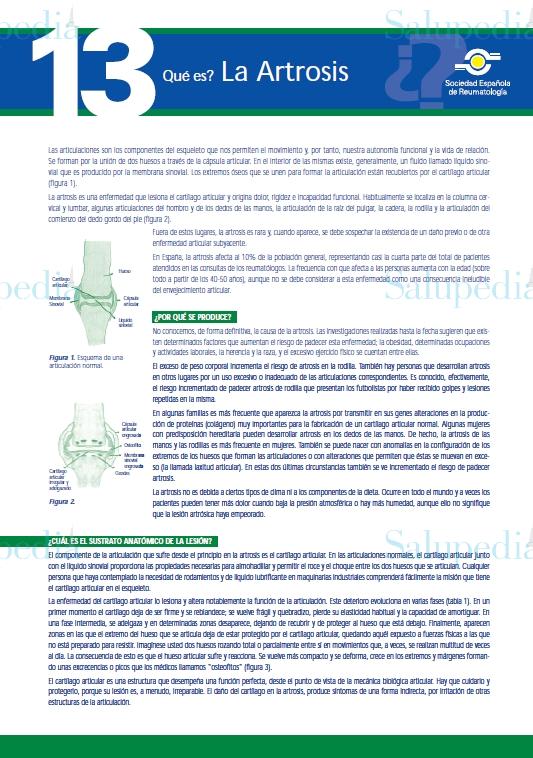 Cache grafica http://www.ser.es/ArchivosDESCARGABLES/Folletos/13.pdf  