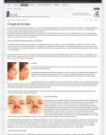 Captura de http://www.secpre.org/index.php?option=com_content&view=article&id=116:rinoplastia&catid=36:cirugiaestetica&Itemid=75