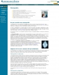 Captura de http://www.radiologyinfo.org/sp/info.cfm?pg=mammo