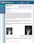 Captura de http://www.webpediatrica.com/endocrinoped/informacion_padres/edad_osea.htm