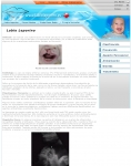 Captura de http://www.labioleporino.es/labio_leporino.php