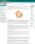 Captura de http://www.fisterra.com/Salud/1infoConse/cataratas.asp