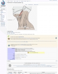 Captura de http://commons.wikimedia.org/w/index.php?title=File:Musculi_colli_stylohyoideus.svg&uselang=es