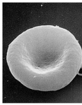Captura de http://upload.wikimedia.org/wikipedia/commons/2/24/Red_White_Blood_cells.jpg