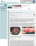 Captura de http://www.aeped.es/infofamilia/temas/angioma.htm