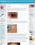 Captura de http://ocularis.es/blog/?p=173