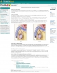 Captura de http://www.fisterra.com/Salud/3proceDT/vasectomia.asp