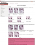 Captura de http://www.gencat.cat/salut/depsalut/html/es/dir92/csbas10.htm